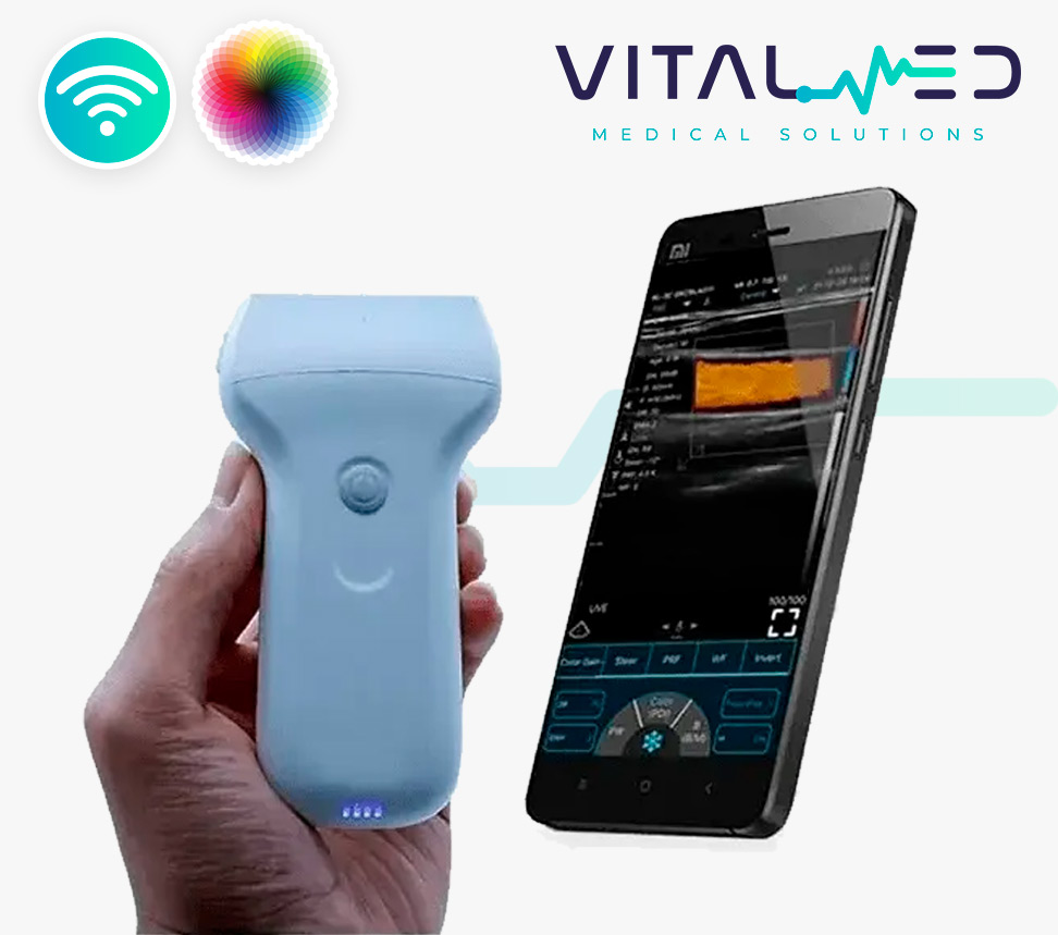 Ultrasonido WiFi